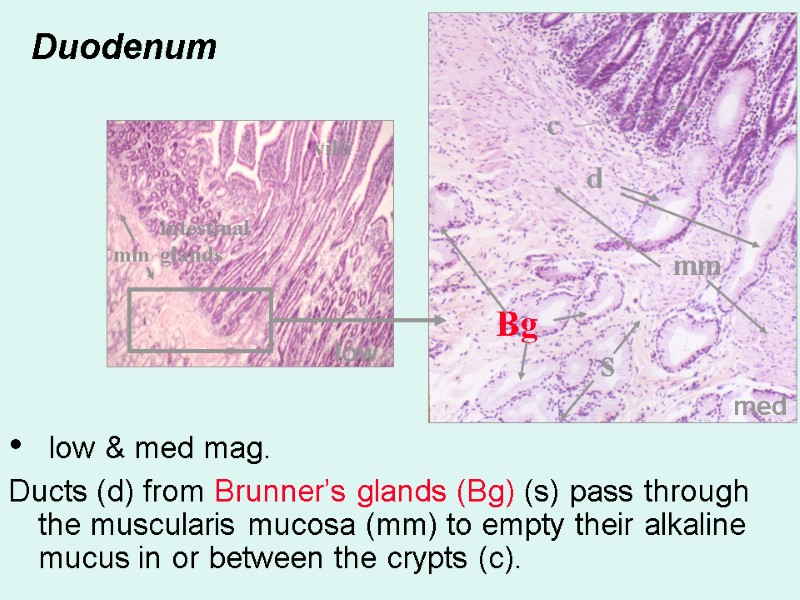 Duodenum  low & med mag. Ducts (d) from Brunner’s glands (Bg) (s) pass